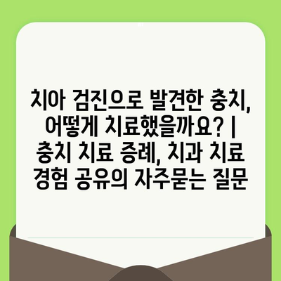 치아 검진으로 발견한 충치, 어떻게 치료했을까요? | 충치 치료 증례, 치과 치료 경험 공유