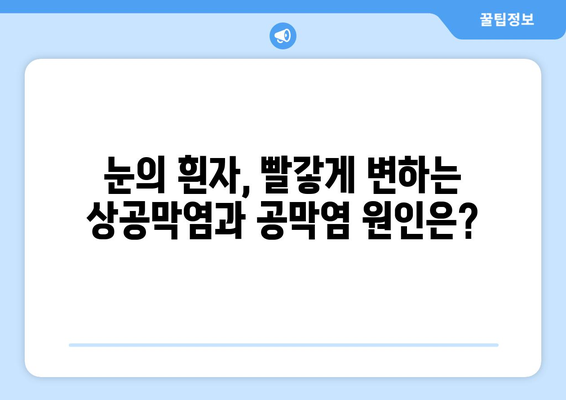 상공막염과 공막염, 원인부터 한의원 치료까지 | 눈 건강, 증상, 치료법, 한방