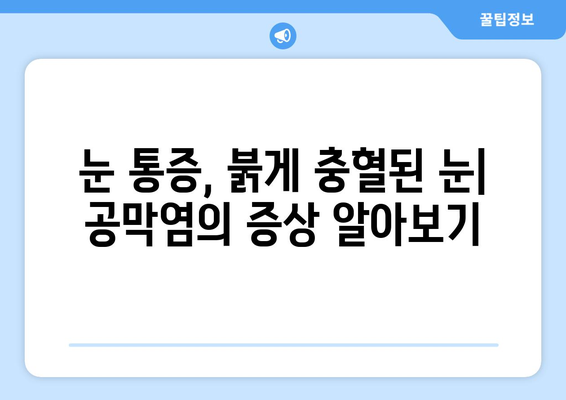 공막염과 눈통| 원인, 증상, 한의학적 치료법 | 눈 통증, 안구 염증, 시력 저하, 한방 치료